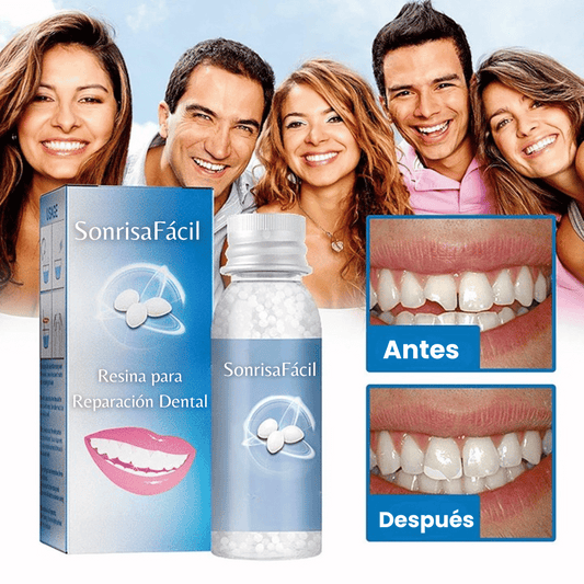 SonrisaFácil - Resina para Reparación Dental
