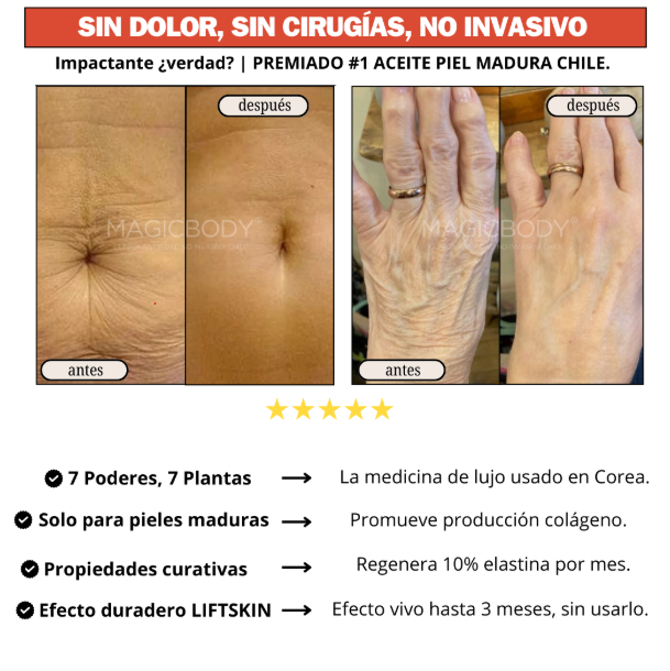 Loción Termoactiva - ¡BYE PIEL MADURA!, SIN CLÍNICAS NI AGUJAS