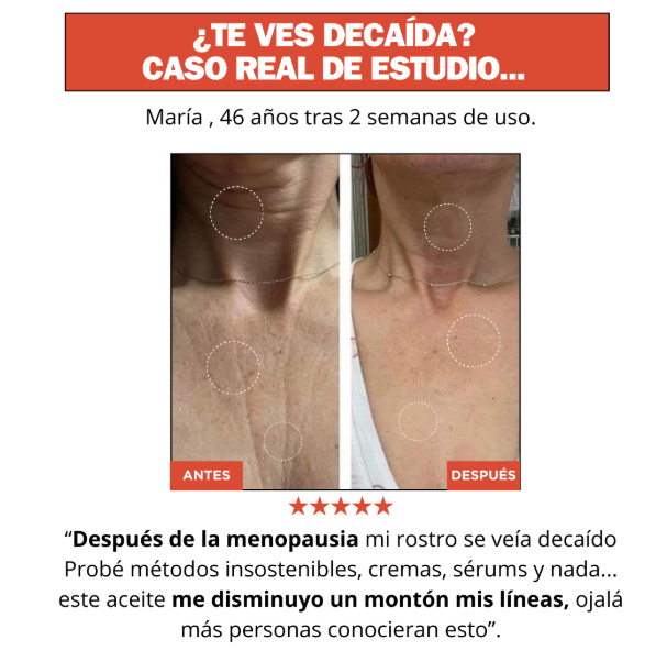 Loción Termoactiva - ¡BYE PIEL MADURA!, SIN CLÍNICAS NI AGUJAS
