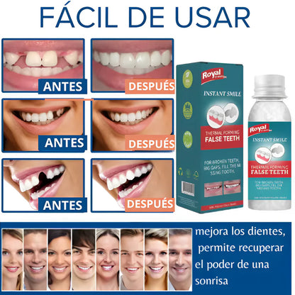 Paga 1 y lleva 2- Empastes Moldeables y Dientes Postizos Caseros 🦷