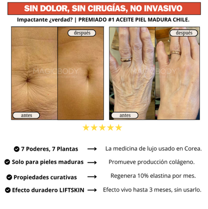 Loción Termoactiva - ¡BYE PIEL MADURA!, SIN CLÍNICAS NI AGUJAS