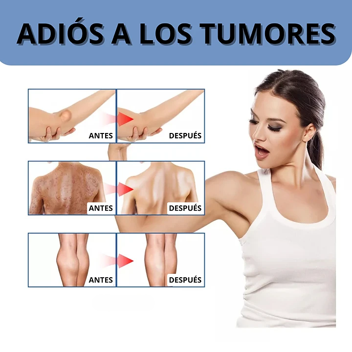 SPRAY ELIMINACIÓN LIPOMA 2x1