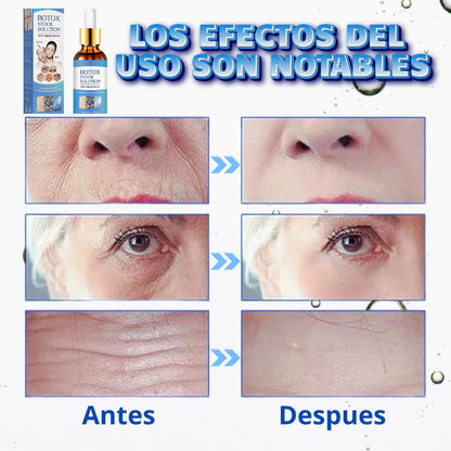 Botox Stock Solution Suero antiarrugas