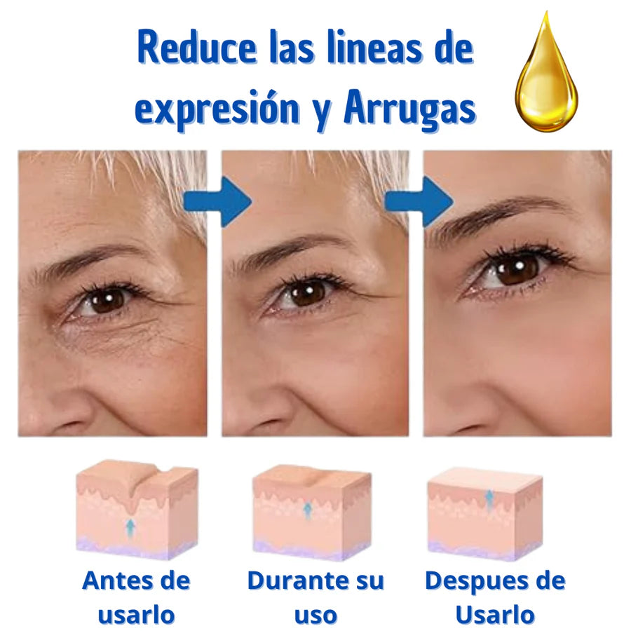 Botox Stock Solution Suero antiarrugas