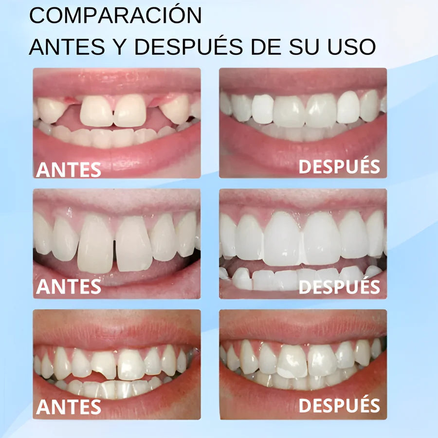 Paga 1 y lleva 2- Empastes Moldeables y Dientes Postizos Caseros 🦷
