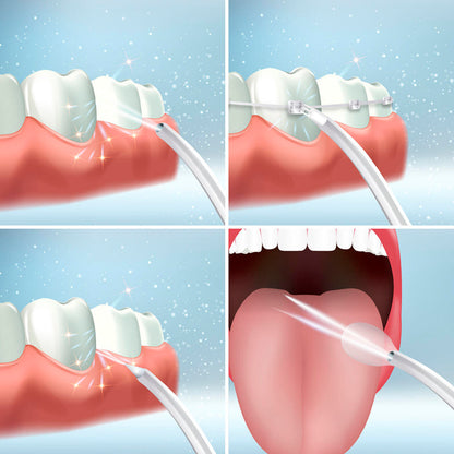 HidroLimpieza Pro- Irrigador Dental Portátil