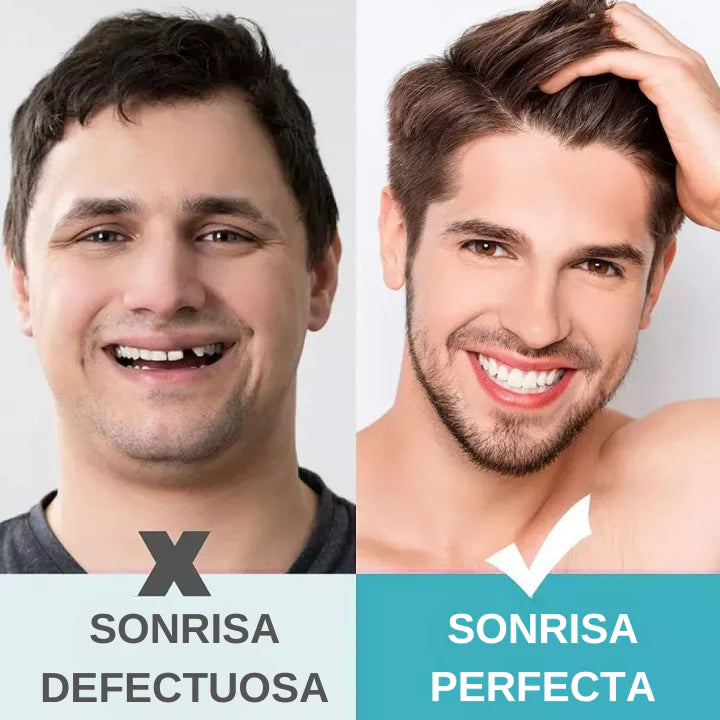 Paga 1 y lleva 2- Empastes Moldeables y Dientes Postizos Caseros 🦷